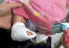 Cek Stunting Berujung Dugaan Malpraktek, Kaki Bayi di Medan Memprihatinkan